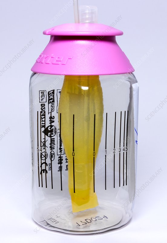 Infusor